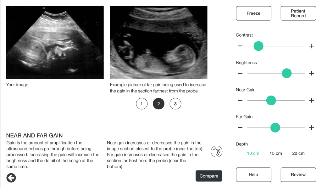 Comparing ultrasound images